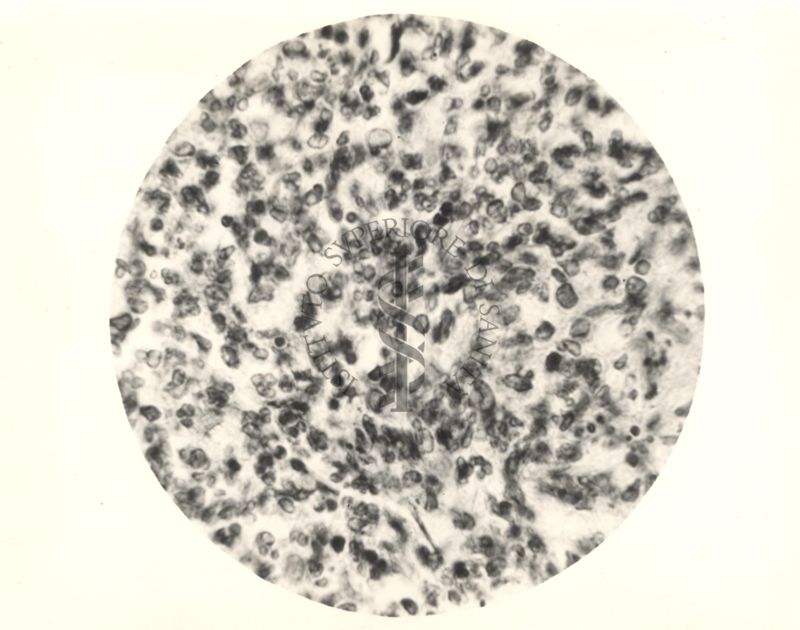 Organo di topo inoculato con tubercolina