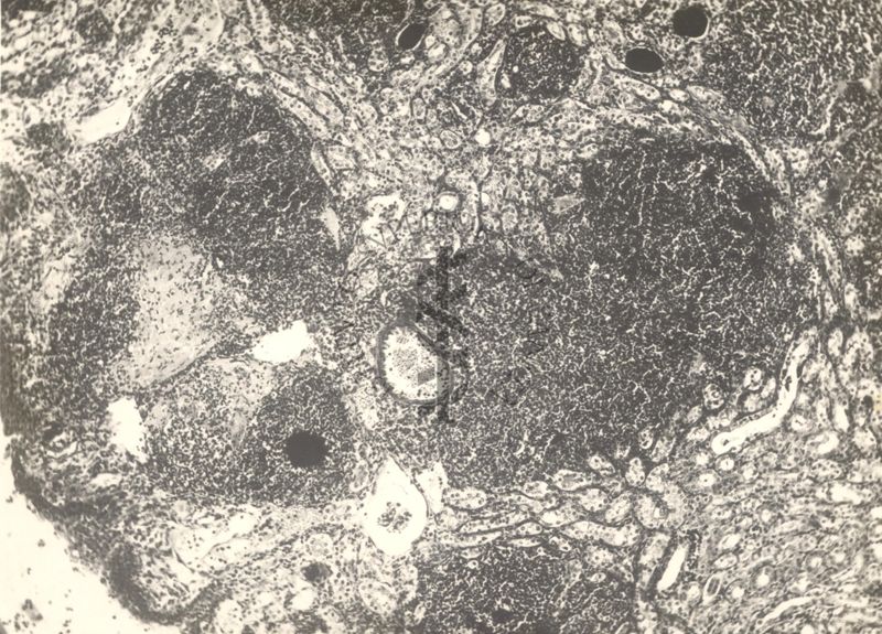 Organo di topo inoculato con tubercolina