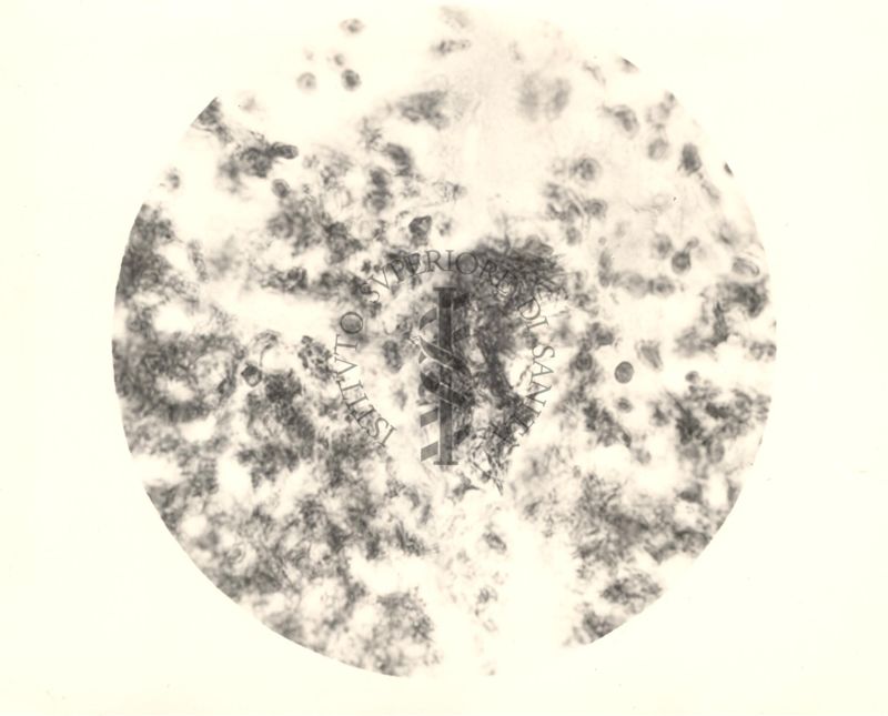 Organo di topo inoculato con tubercolina