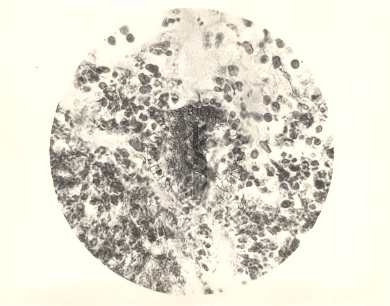 Organo di topo inoculato con tubercolina