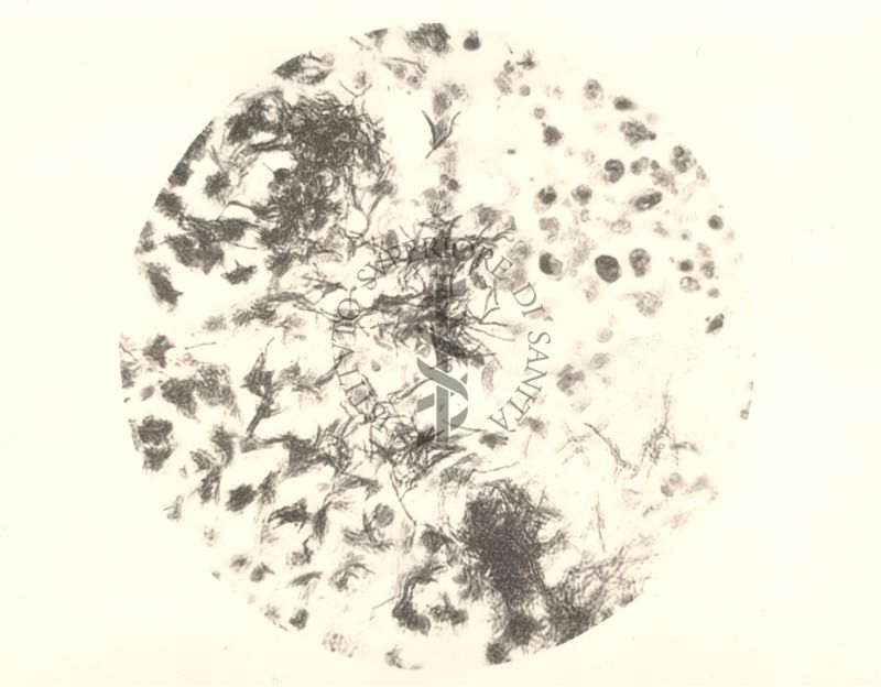 Organo di topo inoculato con tubercolina