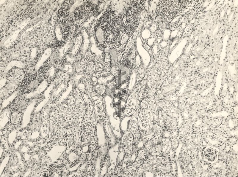 Organo di topo inoculato con tubercolina