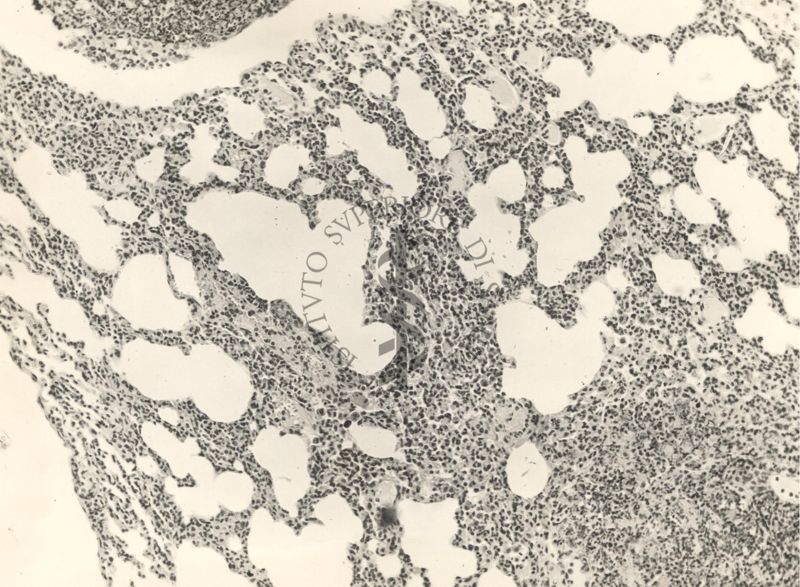 Organo di topo inoculato con tubercolina