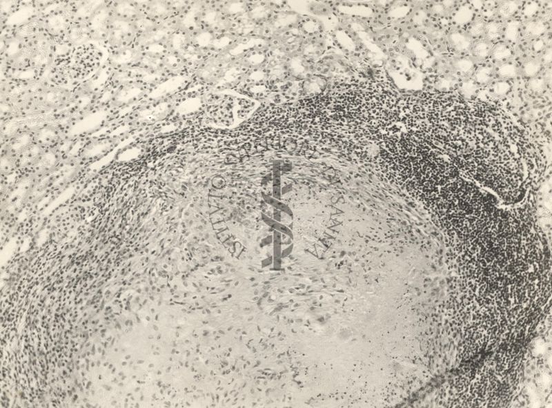 Organo di topo inoculato con tubercolina