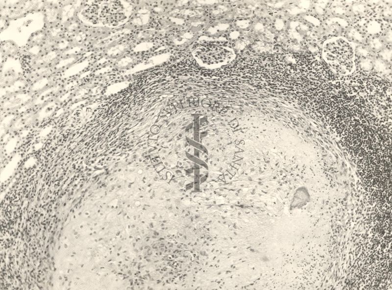 Organo di topo inoculato con tubercolina