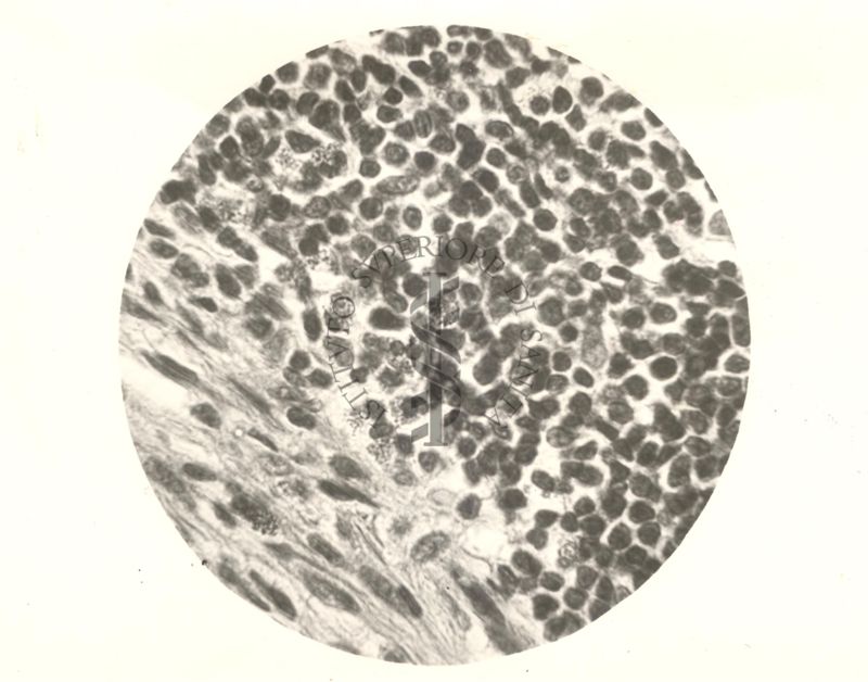 Organo di topo inoculato con tubercolina