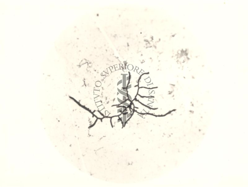 Mycobacterium pellegrini - coltura su vetrino