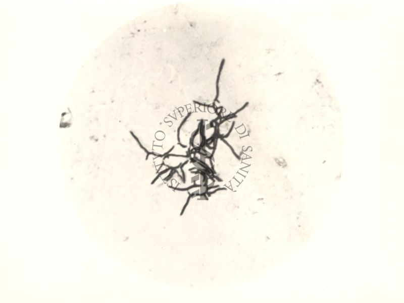 Mycobacterium pellegrini - coltura su vetrino