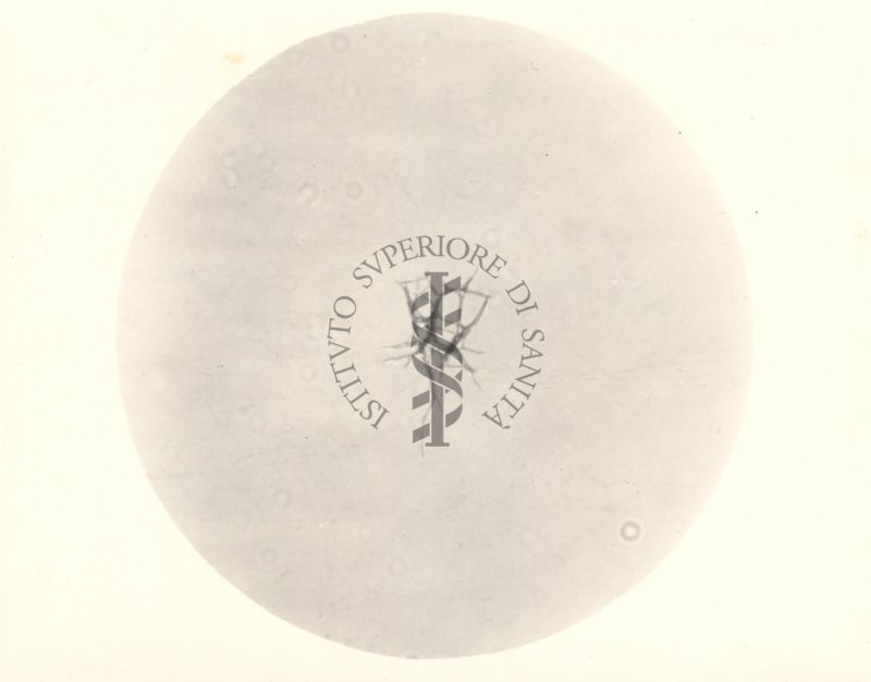 Mycobacterium pellegrini - coltura su vetrino