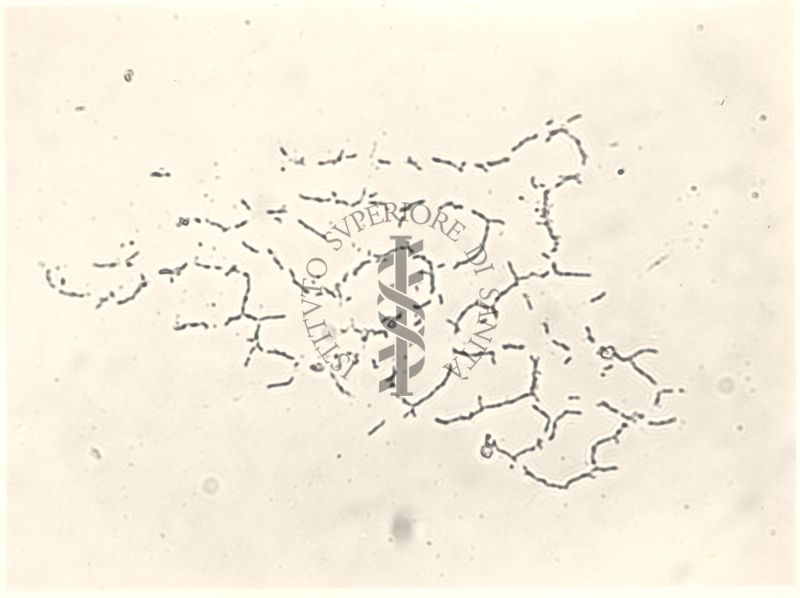 Mycobacterium