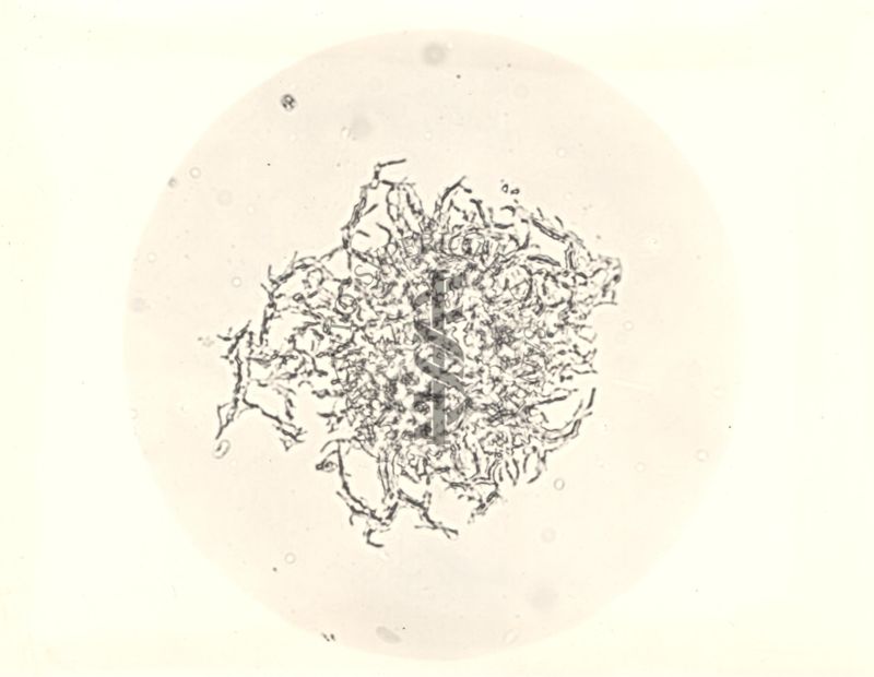 Micro colonie di Flei