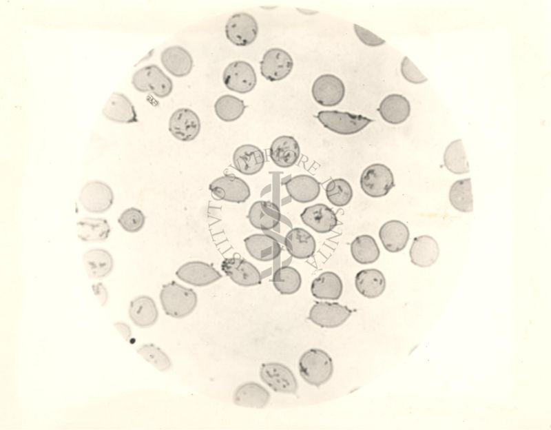 Bartonella muris