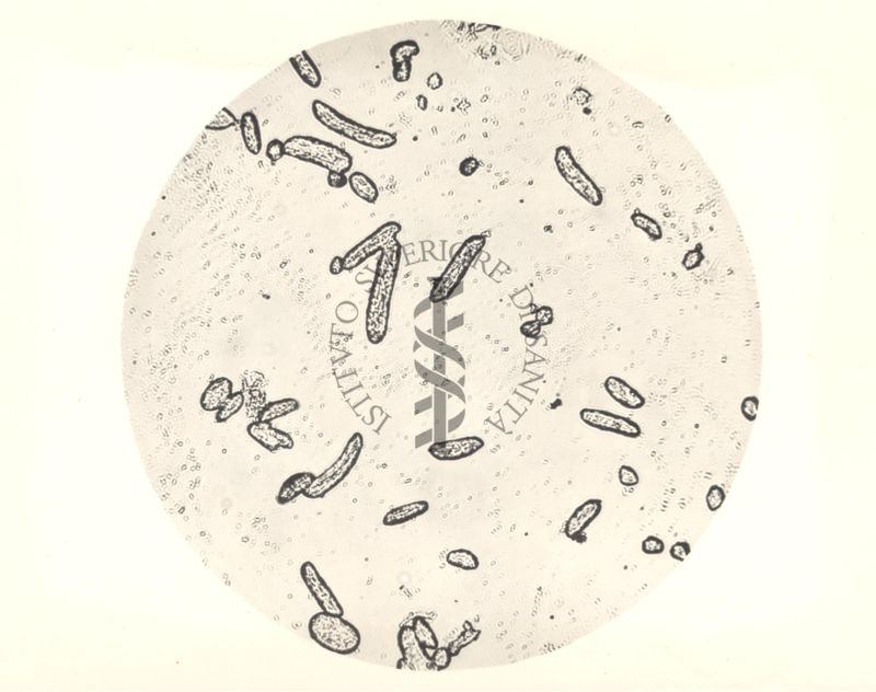 Immagine al microscopio di Colonie di Mycobacterium phlei in terreno liquido