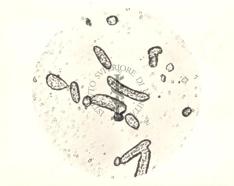 Immagine al microscopio di Colonie di Mycobacterium phlei in terreno liquido