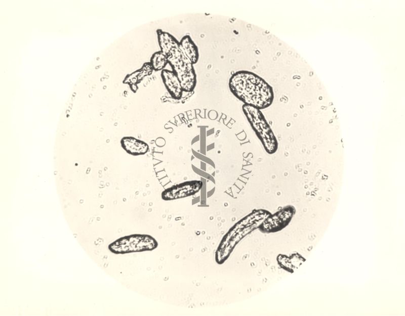 Immagine al microscopio di Colonie di Mycobacterium phlei in terreno liquido