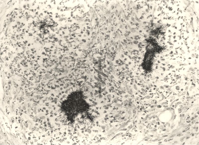 Immagine al microscopio di preparato di cavia inoculata con Cow 70