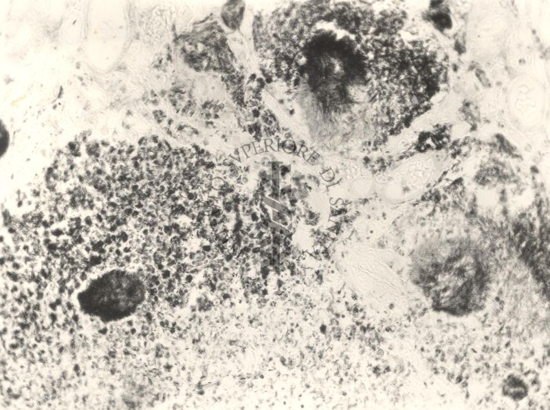 Immagine al microscopio di preparato di topino inoculato con Cow 70