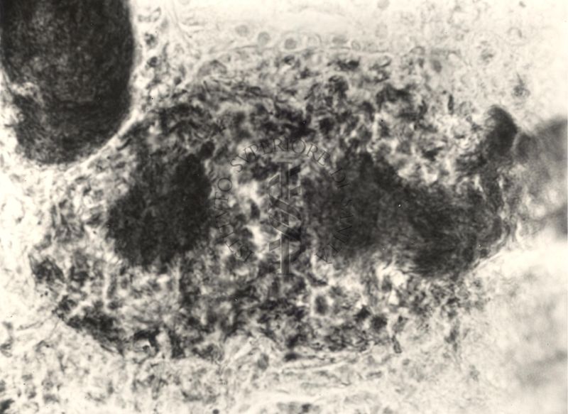 Immagine al microscopio di preparato di topino inoculato con Cow 70