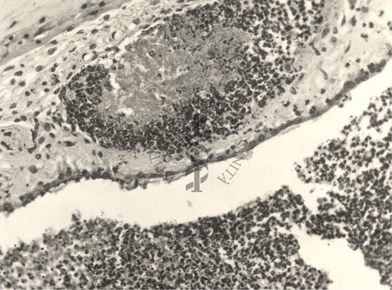 Immagine al microscopio di preparato di topino inoculato con Cow 70