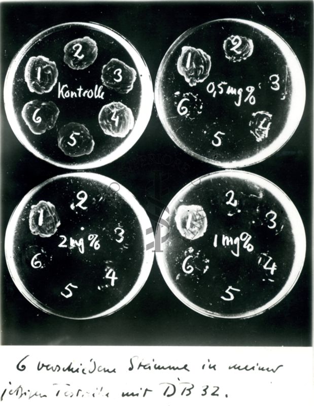 Inibizione di sviluppo di 6 diversi stipiti di gonococchi su piastre con mezzo nutritivo di ascite contenente 0,5 - 2 mgr.% di Uliron C.