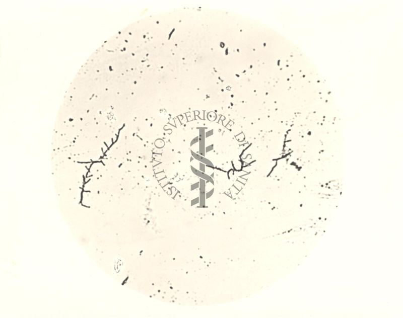 Mycobacterium Cow 70 - coltura su vetrino di 10 ore