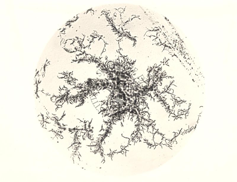 Mycobacterium Cow 70 - coltura su vetrino di 4 giorni