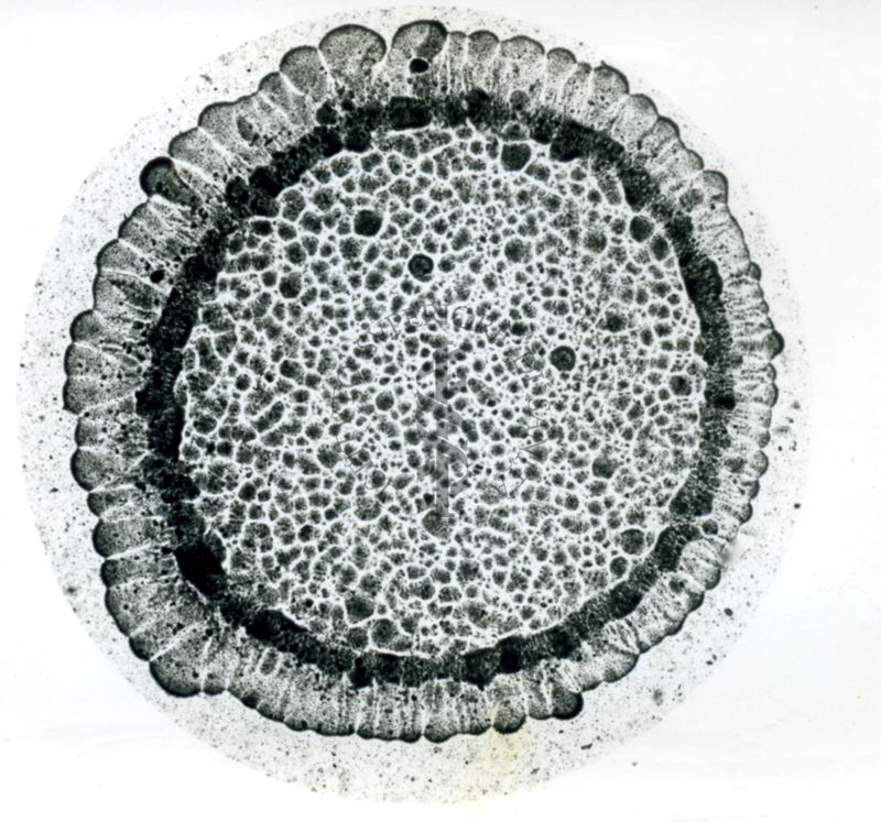 Immagine al microscopio che mostra una Pluricoltura di streptococco emolitico