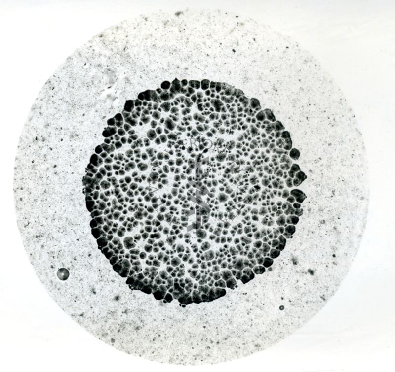 Immagine al microscopio che mostra una Pluricolonia di streptococco non emolitico