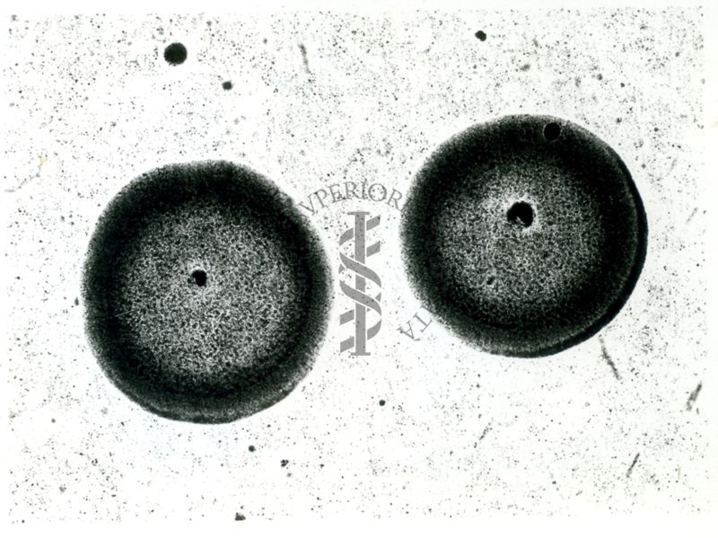 Immagine al microscopio che mostra una Pluricoltura di streptococco emolitico