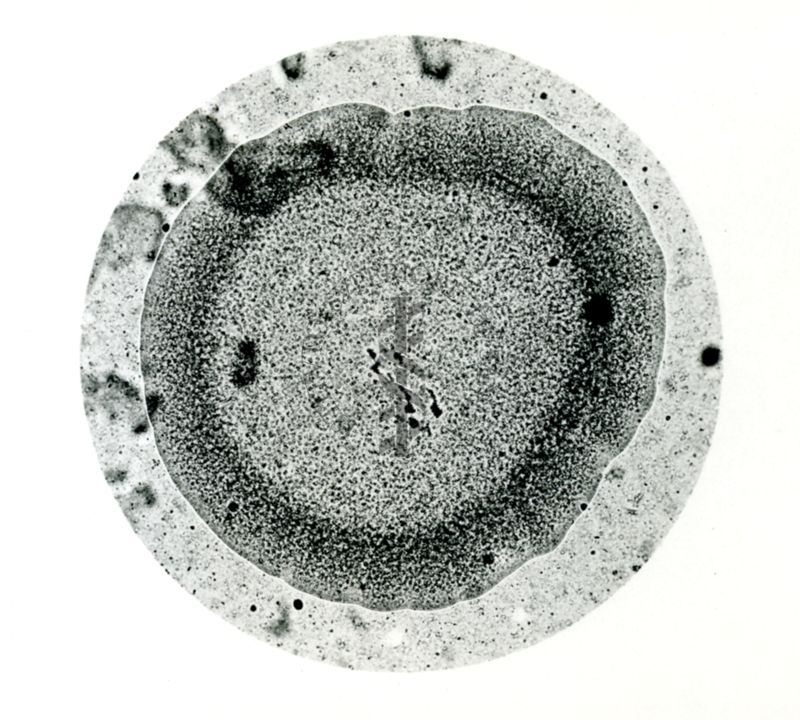 Immagine al microscopio che mostra una Pluricoltura di streptococco emolitico