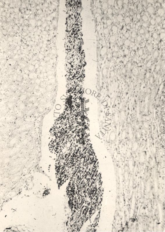 Sezione istologica di rene di topino inoculato con Mycobacterium minetti. Il bacinetto contiene numerose cellule flogistiche e micobatteri