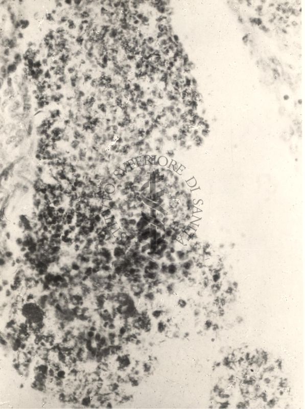 Sezione istologica di rene di topino inoculato con Mycobacterium minetti. Cellule flogistiche e micobatteri nel bacinetto