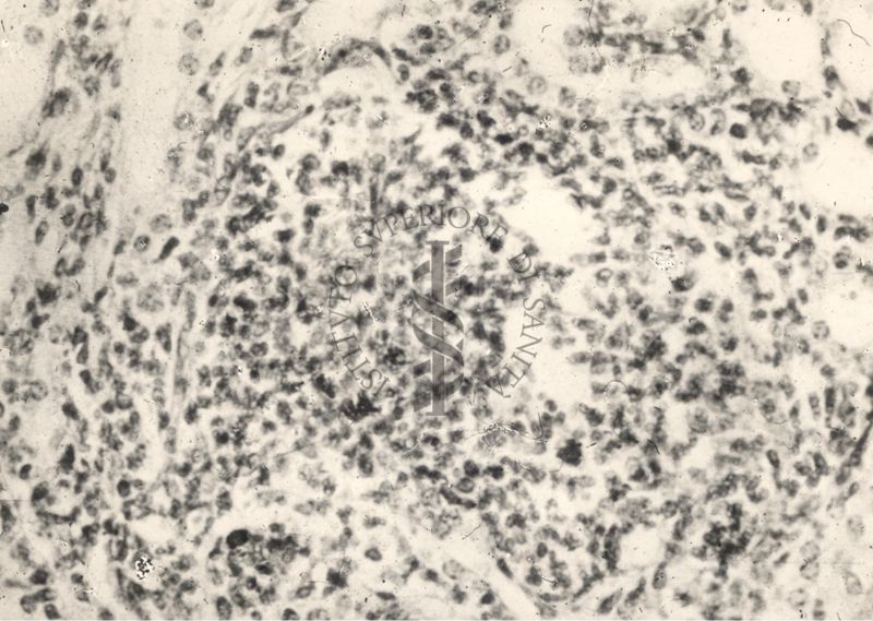 Sezione istologica di rene di cavia inoculata con Mycobacterium minetti. Micobatteri in un piccolo focolaio flogistico