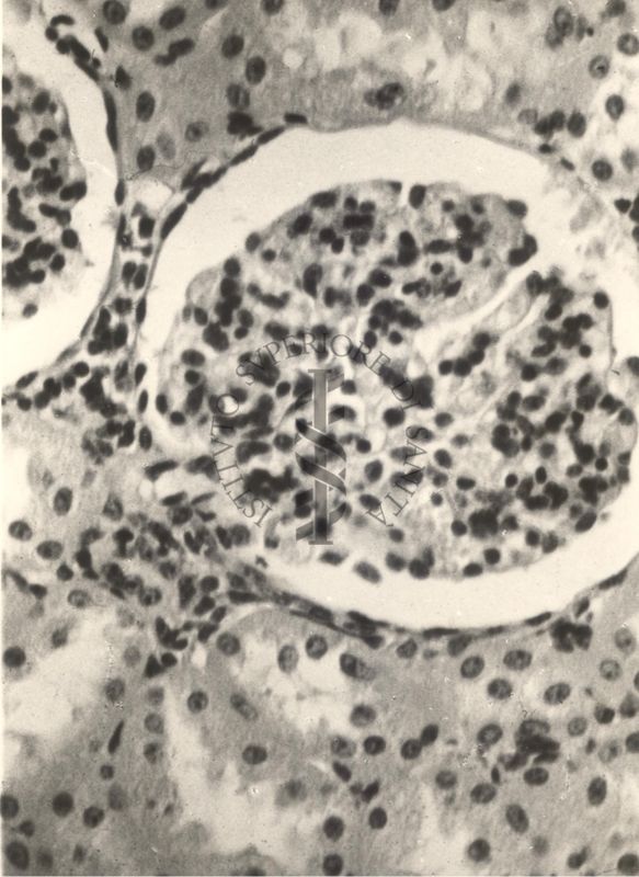 Sezione istologica di rene di vitello inoculato con Mycobacterium minetti. Glomerulo ingrossato e con piccole emorragie