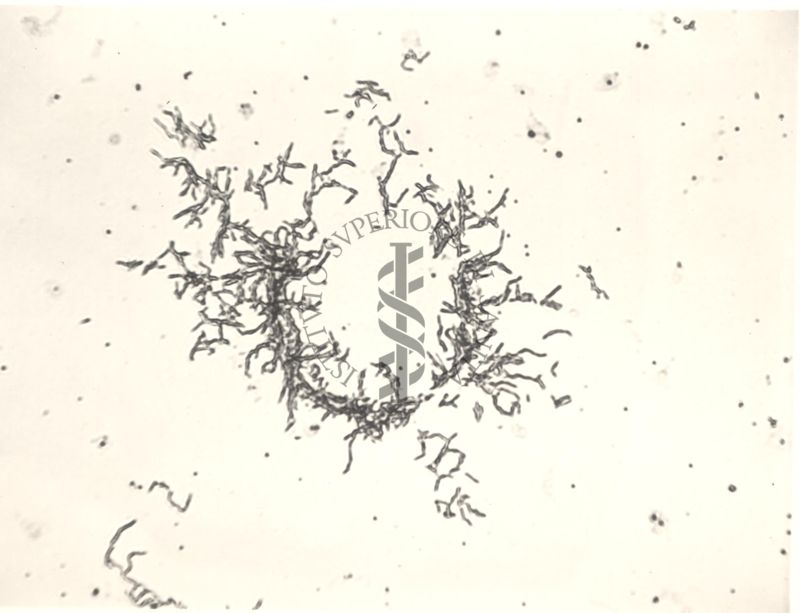 Mycobacterium sp. Ceppo Battaglini - micro colonie