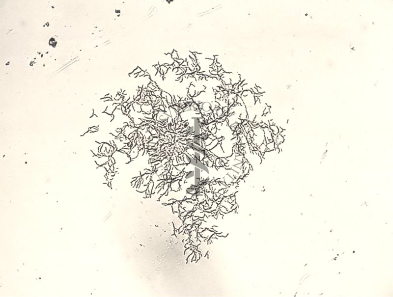 Mycobacterium sp. Ceppo Battaglini - micro colonie