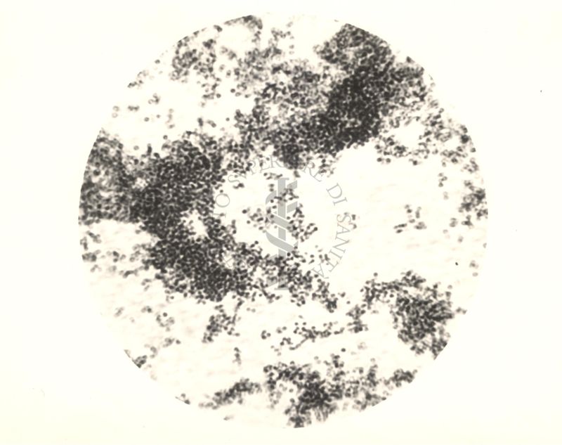 Immagine al microscopio di coltura su piastra di Micrococcus mycetoides Castellani 1942