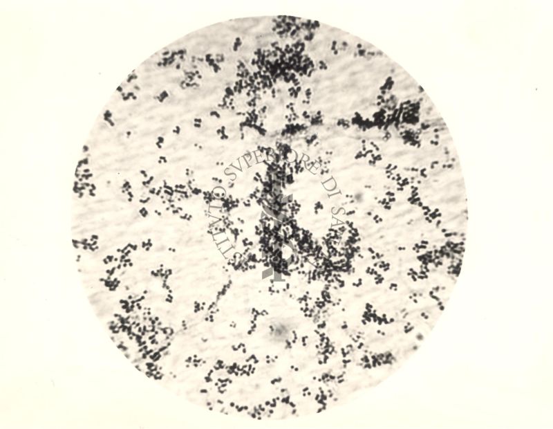 Immagine al microscopio di coltura su piastra di Micrococcus mycetoides Castellani 1942