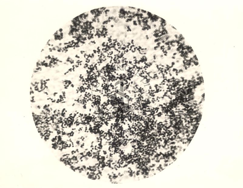 Immagine al microscopio di coltura su piastra di Micrococcus mycetoides Castellani 1942