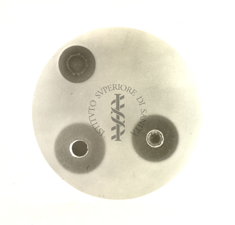 Azione antibiotica di alcuni microrganismi