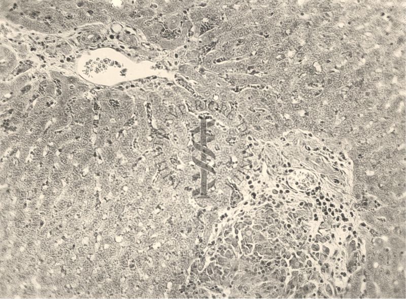 Organo di animale inoculato con Battaglini