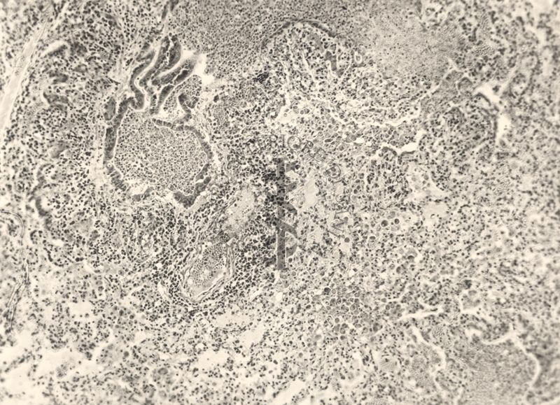 Organo di animale inoculato con Battaglini