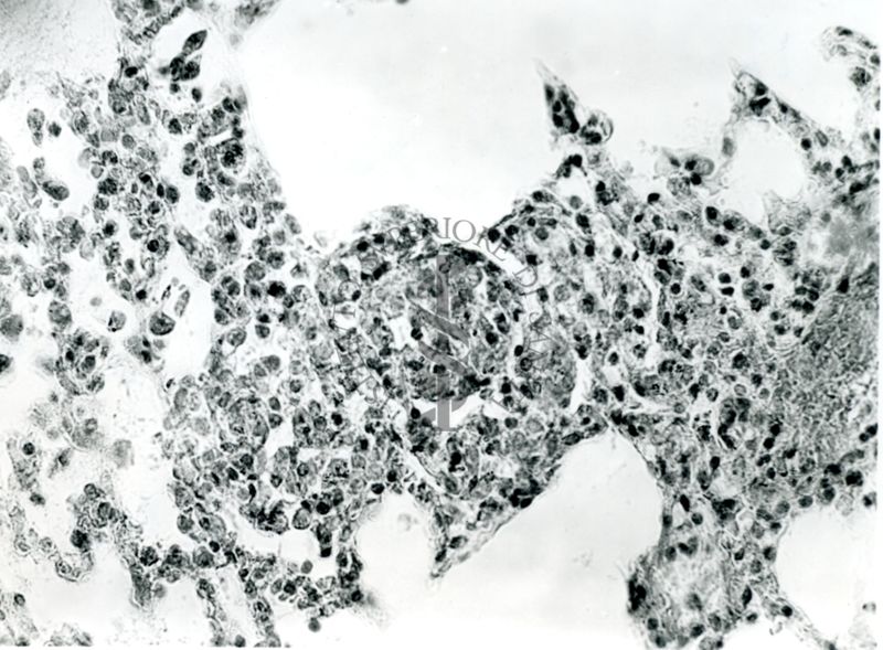 Organi di animali inoculati con Battaglini