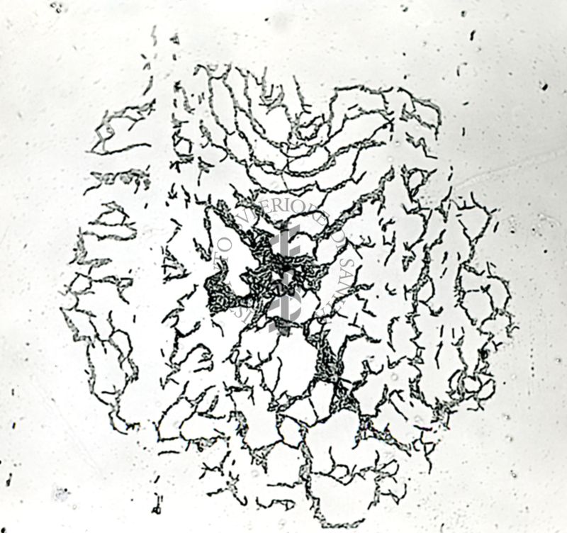 Mycobacterium tuberculosis - var. avium ceppo Sheard