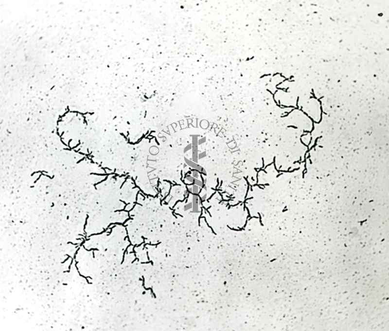 Mycobacterium tuberculosis - var. avium ceppo Sheard