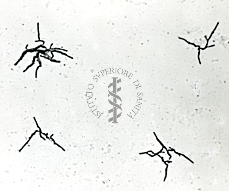 Mycobacterium tuberculosis - ceppo Vallé