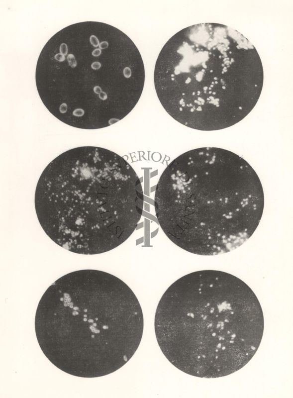 B. prodigioso, virus vaccino, virus dell'electromelia dei roditori (fegato e pelle), virus delle malattie dei canari, virus della malattia di Borna. Fotografie con raggi U.V.