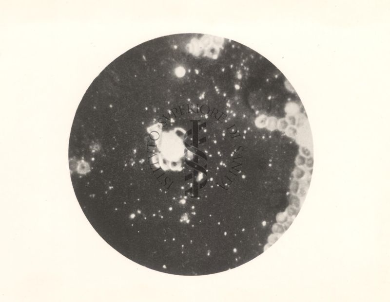 Linfa di afta epizootica (x 600). Microscopio fluorescente di Reichert