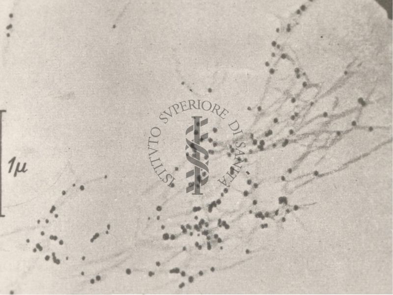 Reazione soluzione oro di Gansche (microscopio elettronico)