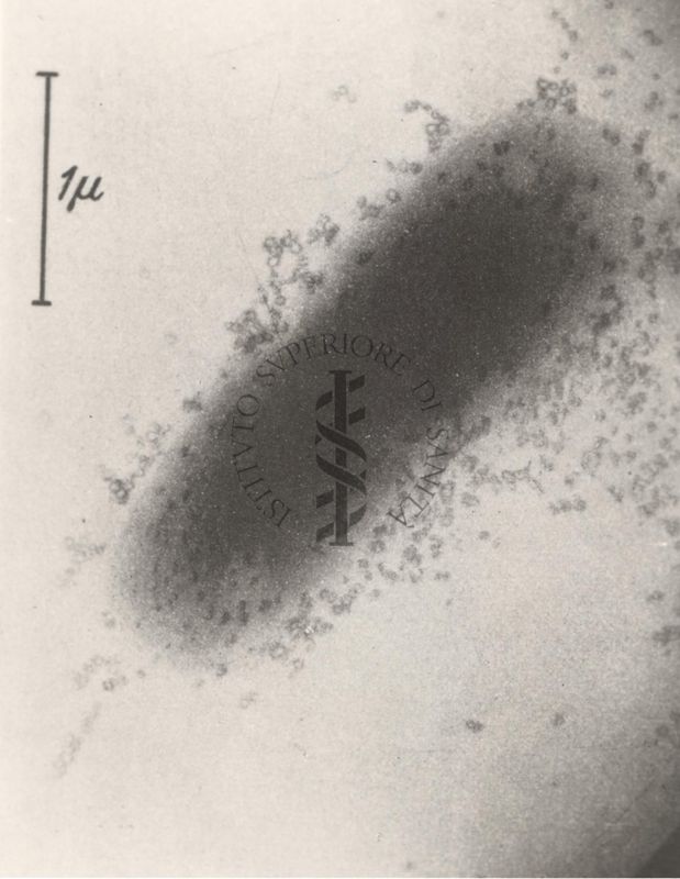 Diverse immagini di Batteriofagi visti al microscopio elettronico